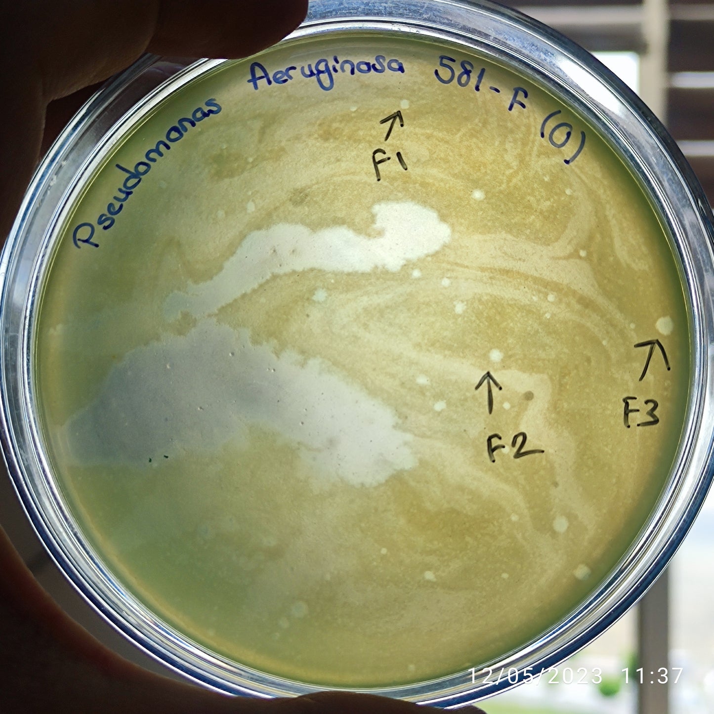Pseudomonas aeruginosa bacteriophage 130581F