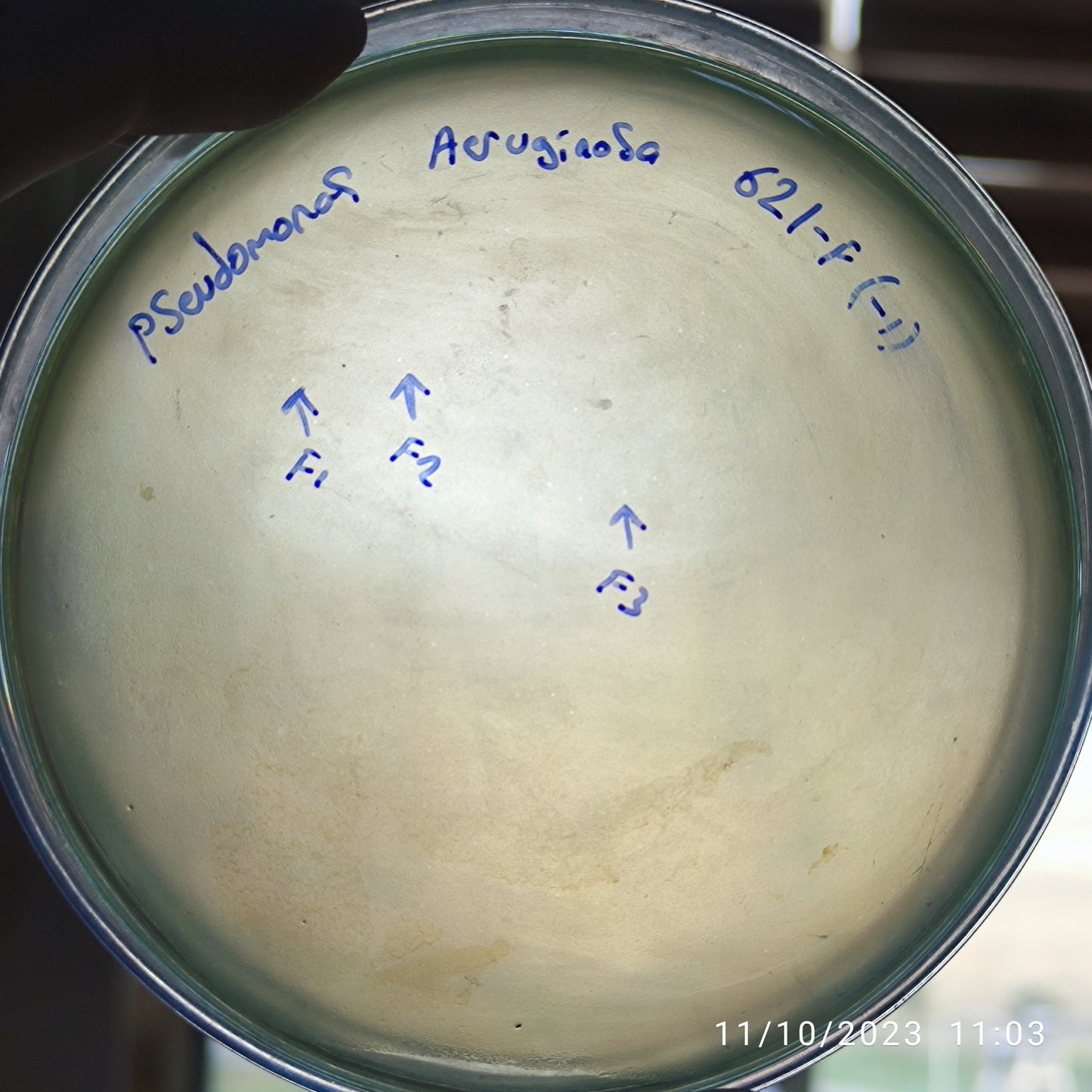 Pseudomonas aeruginosa bacteriophage 130621F
