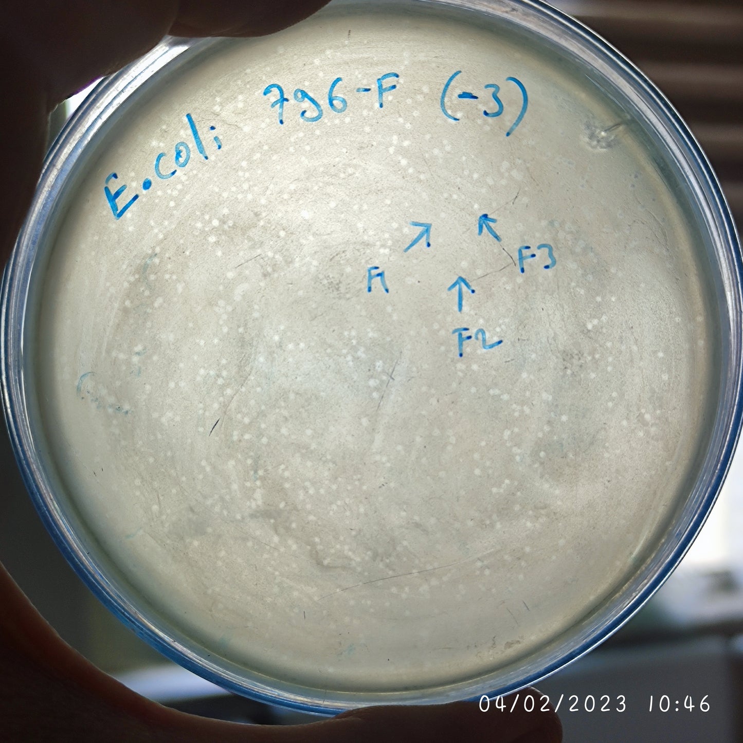 Escherichia coli bacteriophage 100796F