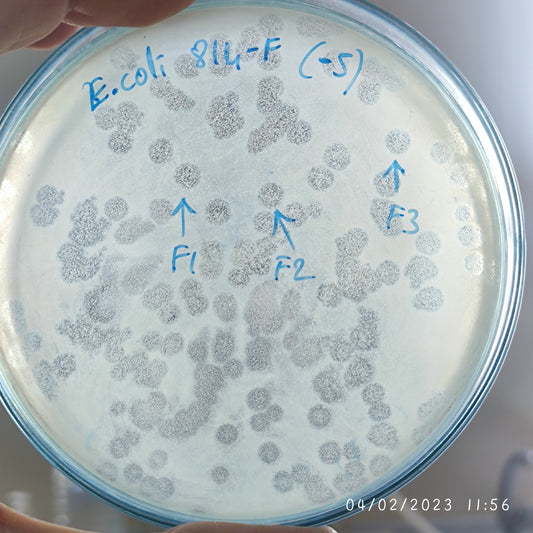 Escherichia coli bacteriophage 100814F