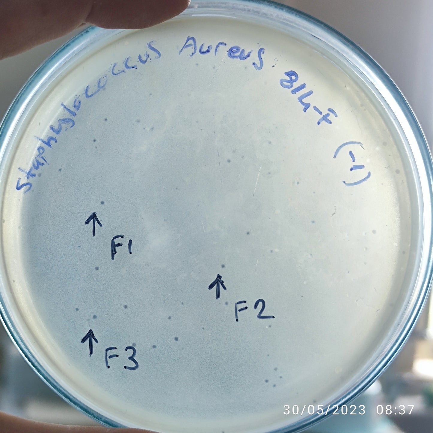Staphylococcus aureus bacteriophage 152814F