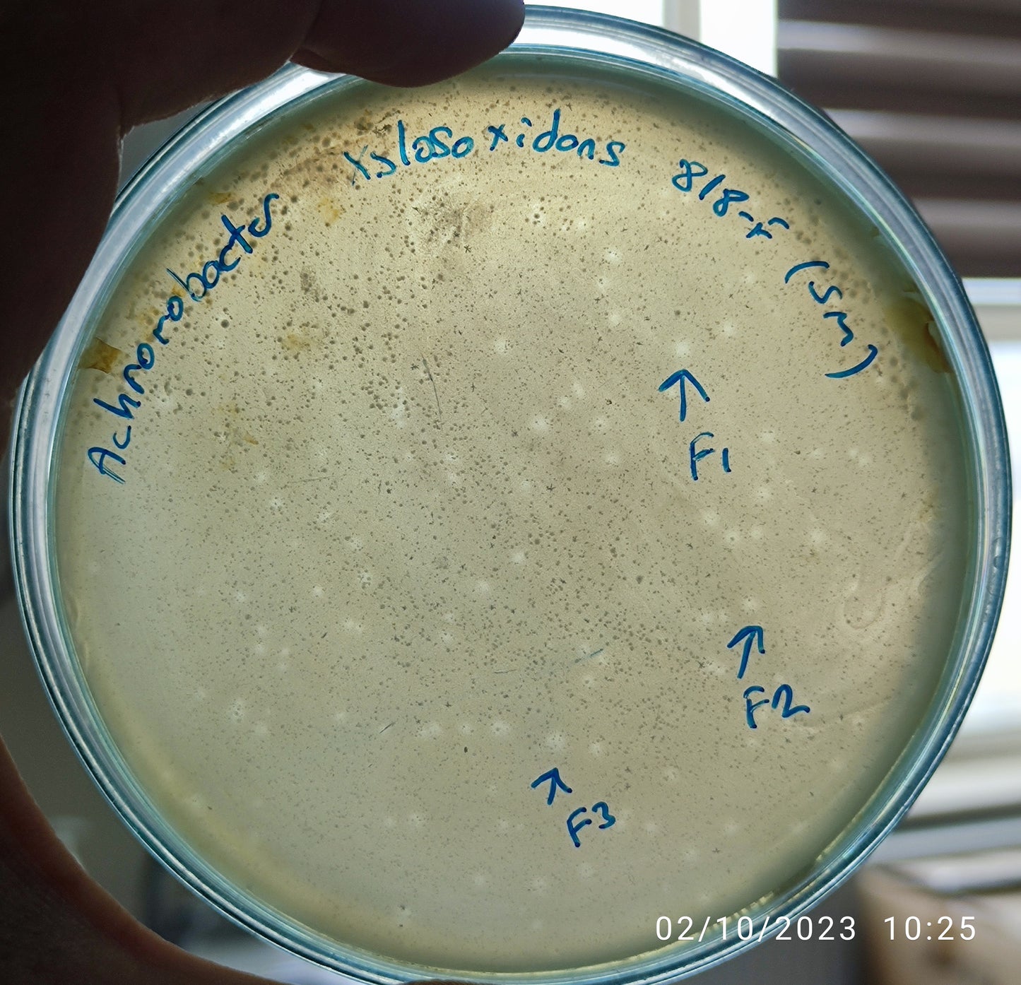 Achromobacter xylosoxidans bacteriophage 200818F