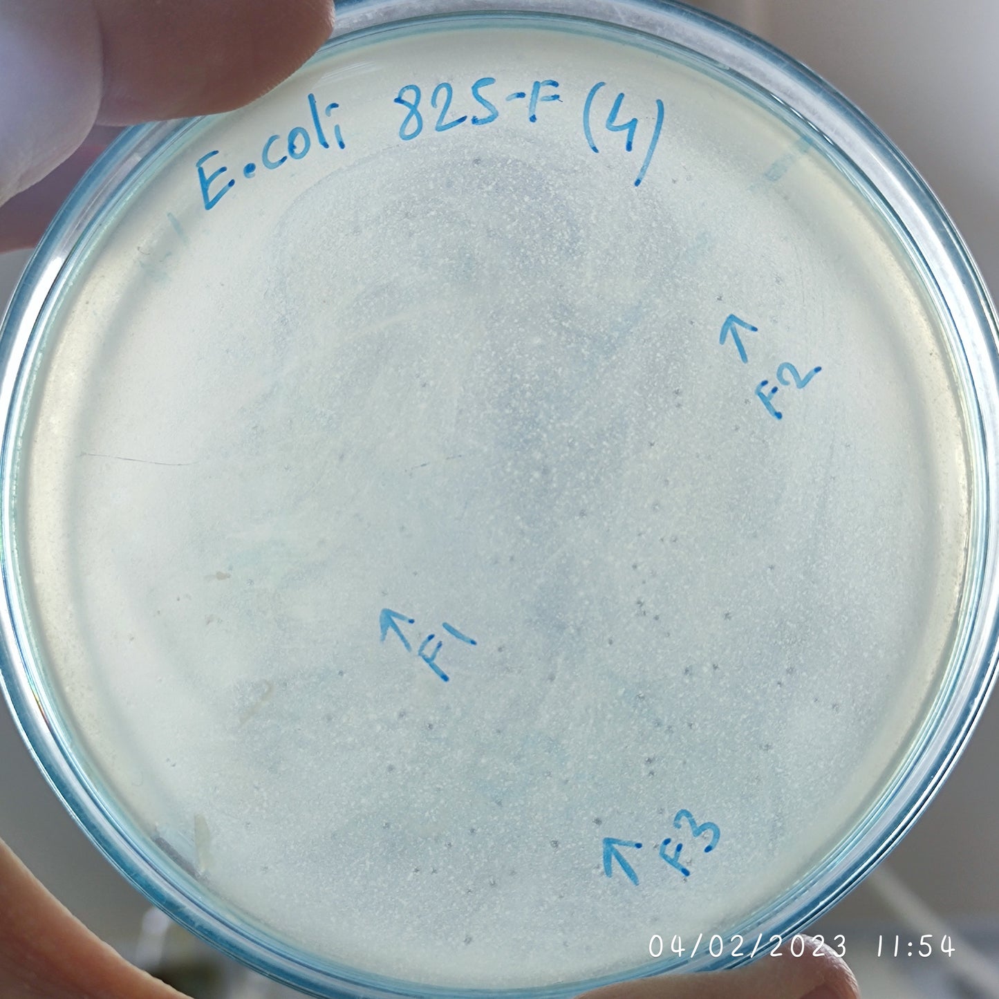Escherichia coli bacteriophage 100825F