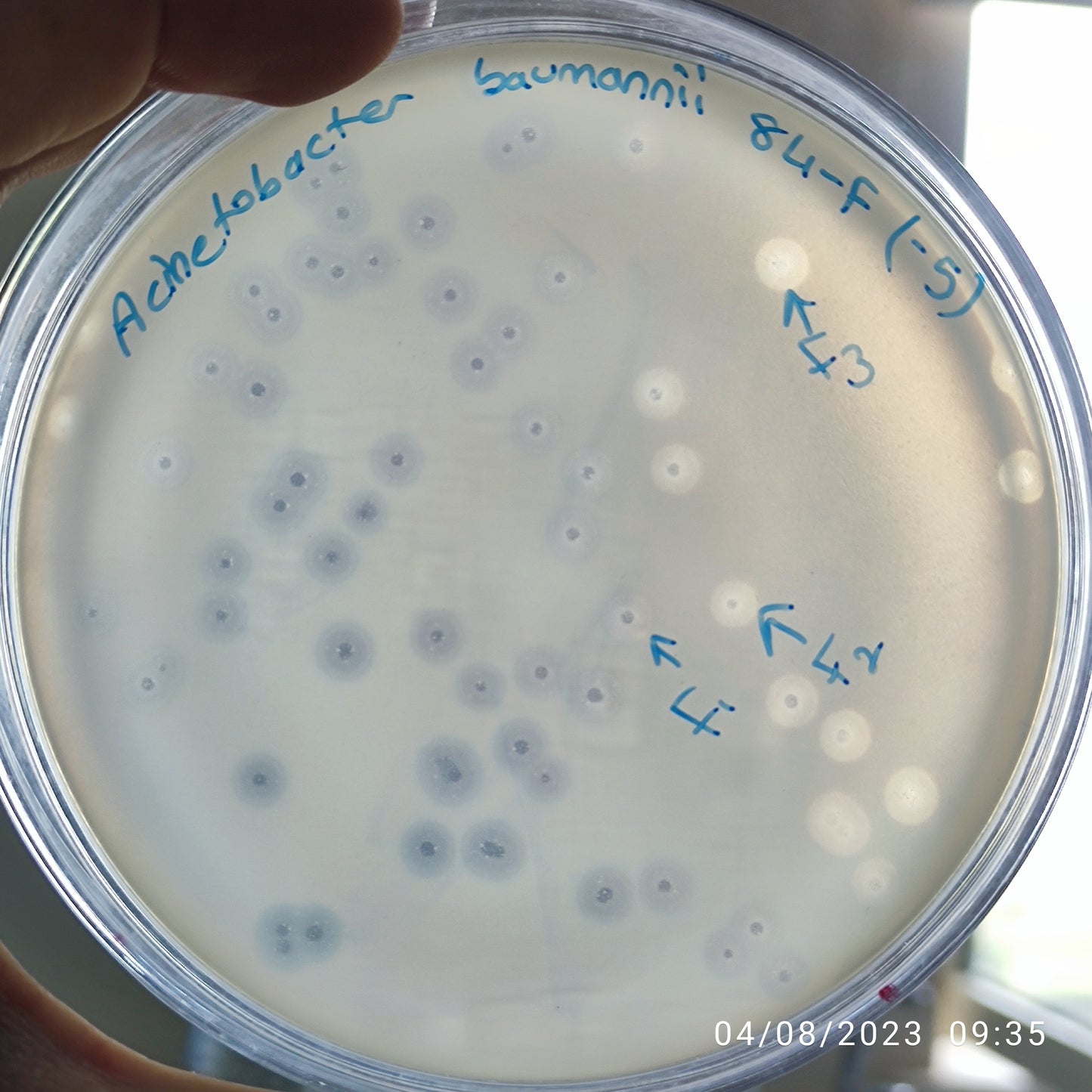 Acinetobacter baumannii bacteriophage 120084F