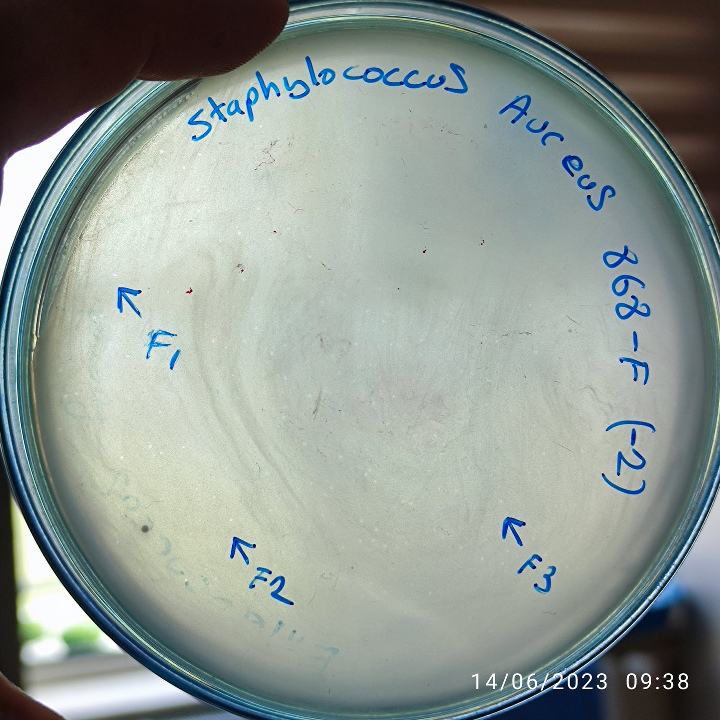 Staphylococcus aureus bacteriophage 152868F