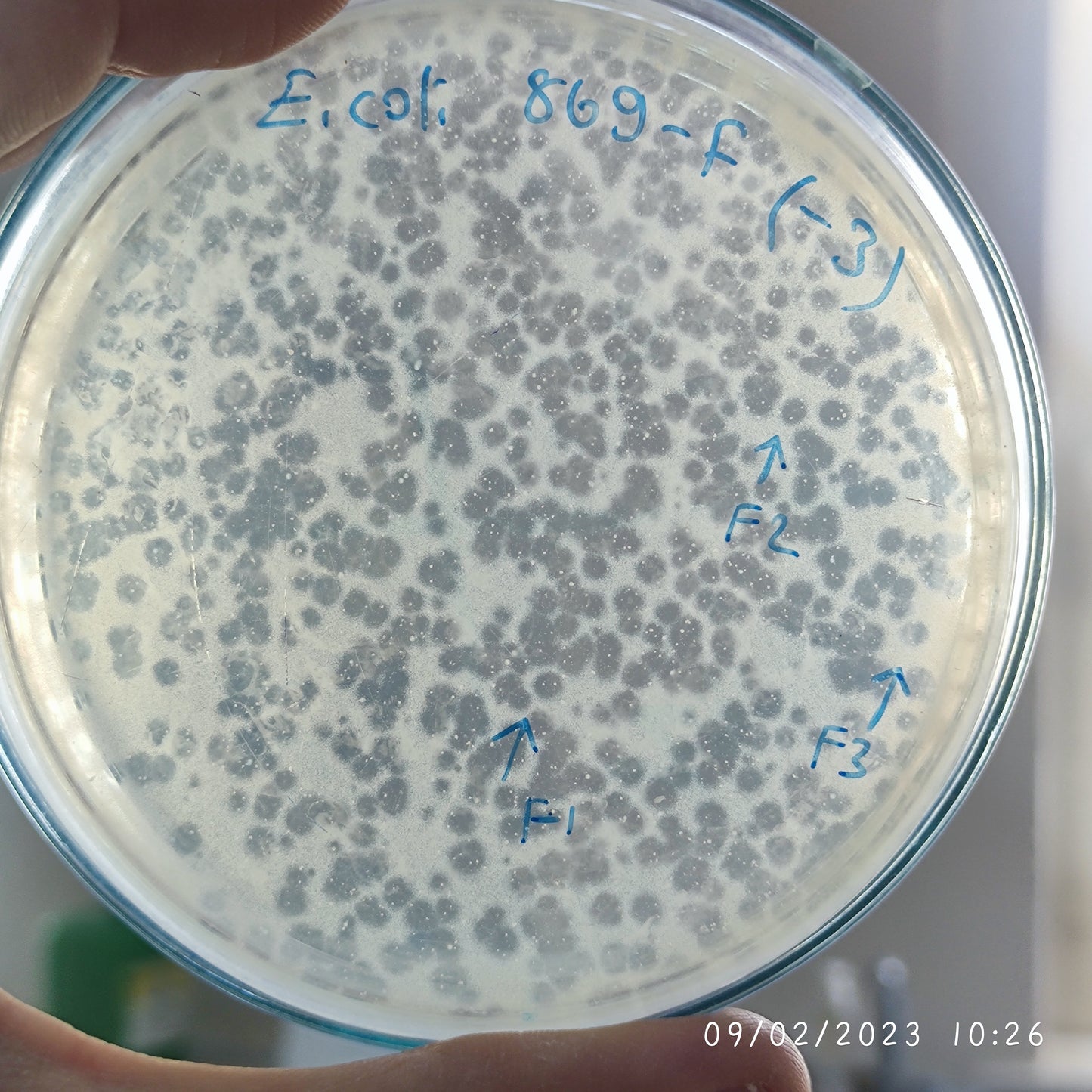 Escherichia coli bacteriophage 100869F