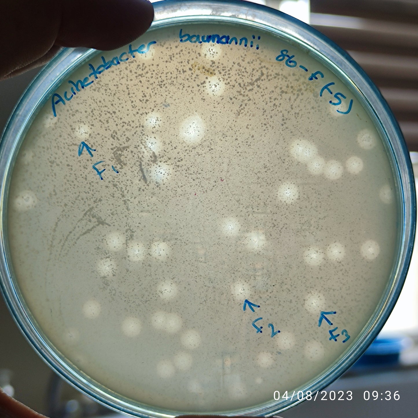 Acinetobacter baumannii bacteriophage 120086F