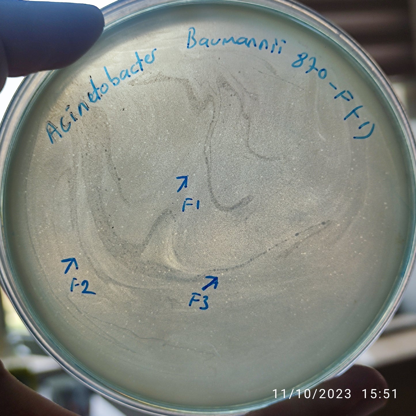 Acinetobacter baumannii bacteriophage 120870F