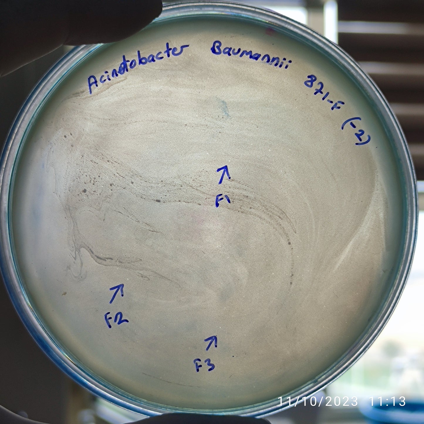 Acinetobacter baumannii bacteriophage 120871F