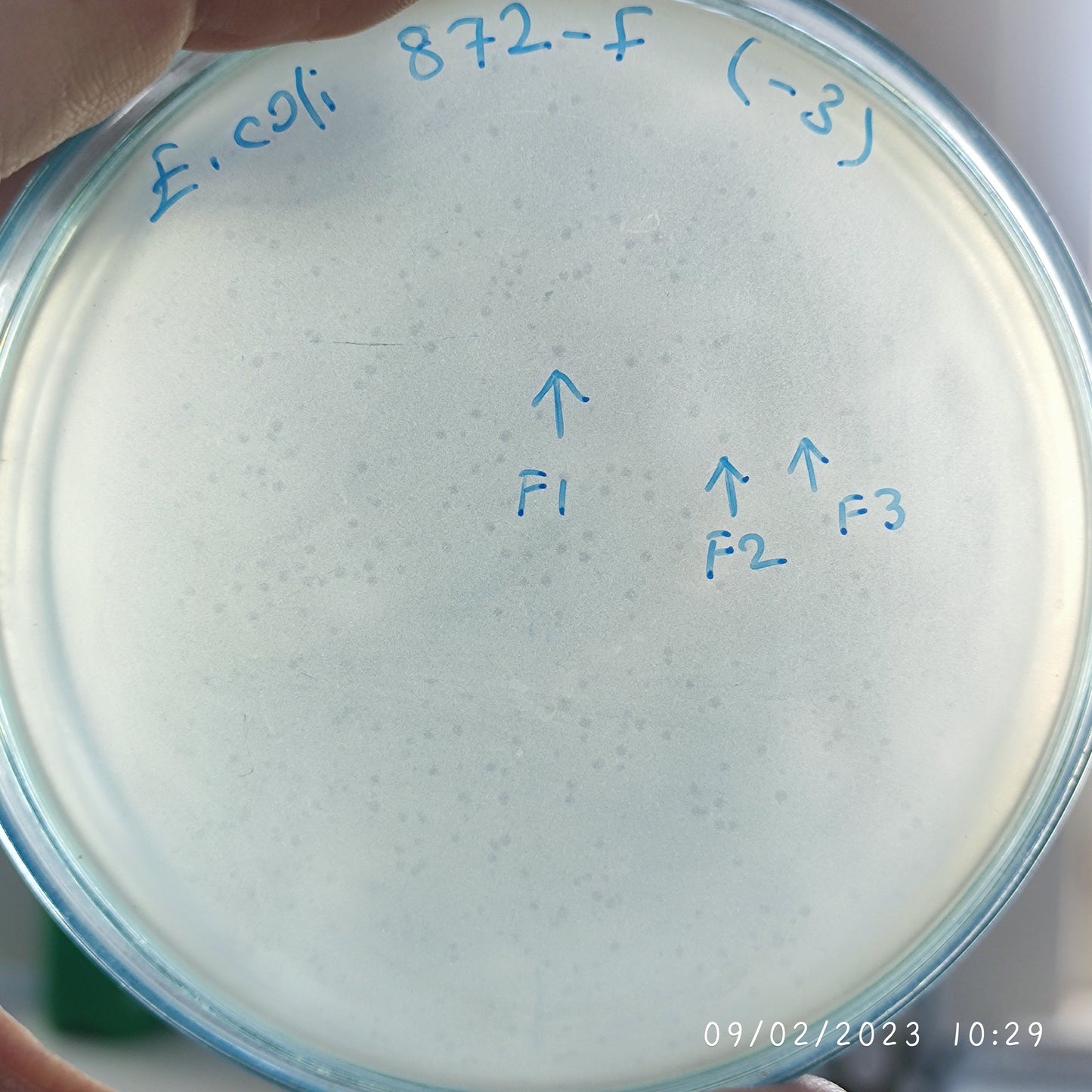 Escherichia coli bacteriophage 100872F