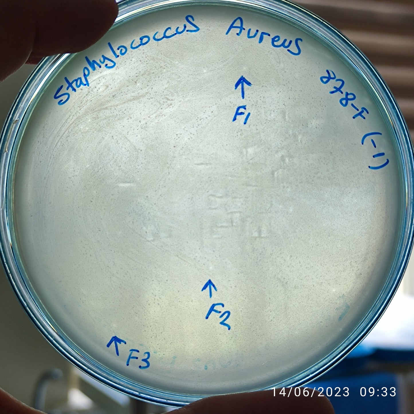 Staphylococcus aureus bacteriophage 152878F