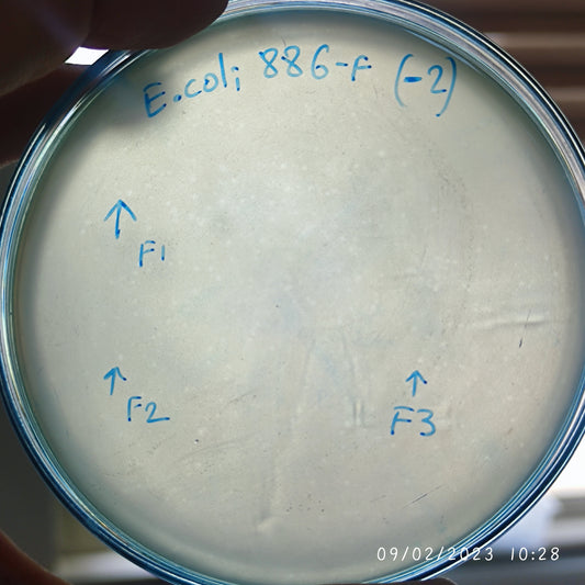 Escherichia coli bacteriophage 100886F