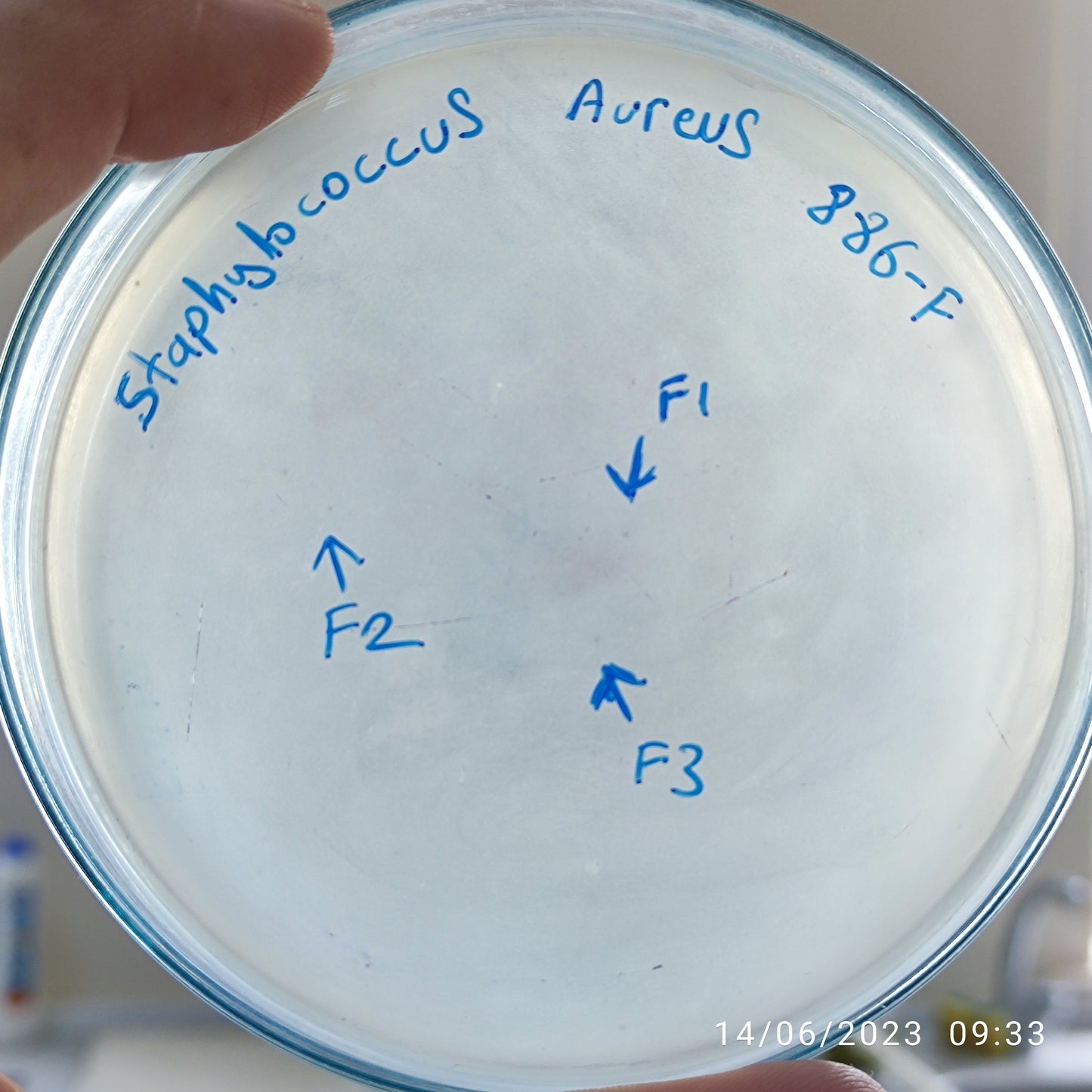 Staphylococcus aureus bacteriophage 152886F