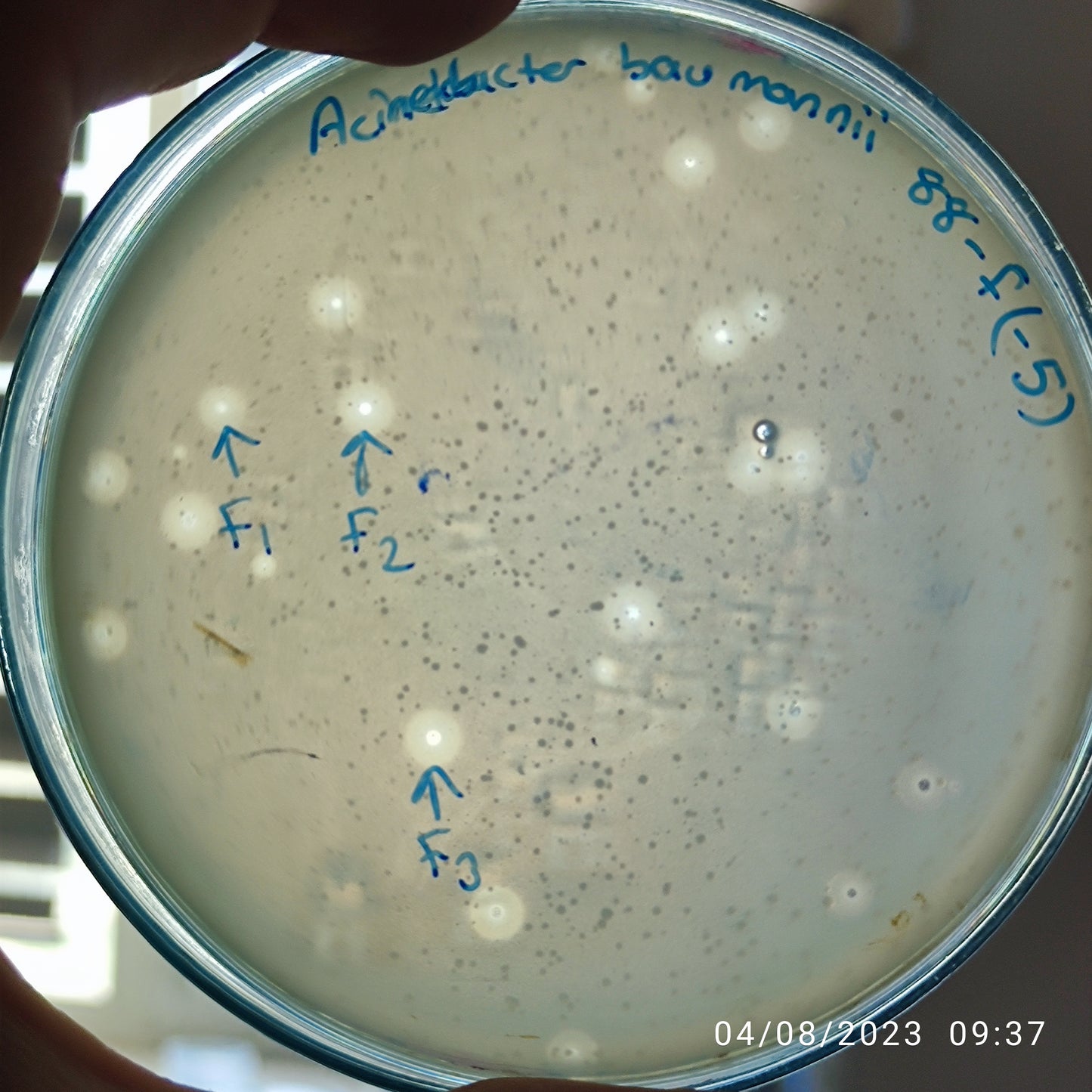 Acinetobacter baumannii bacteriophage 120088F