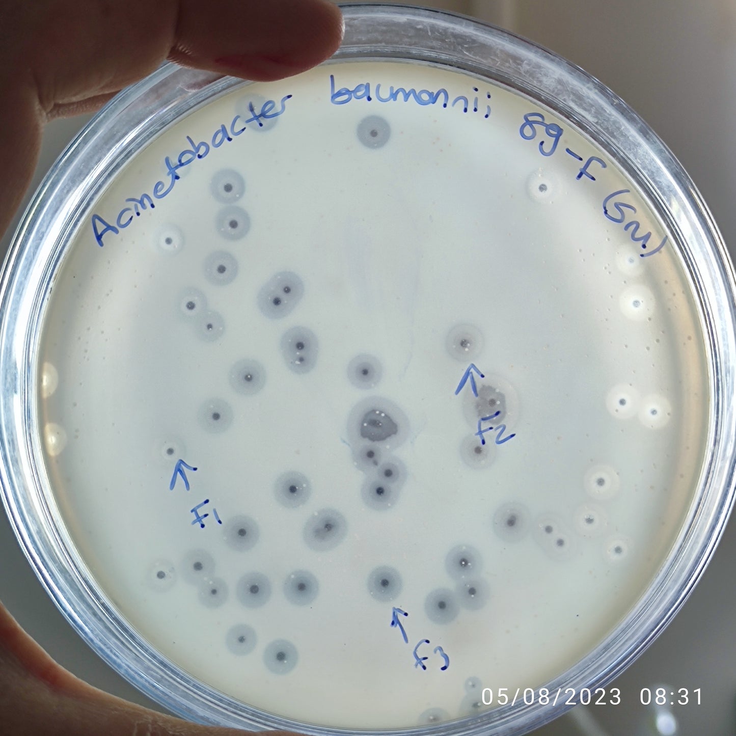 Acinetobacter baumannii bacteriophage 120089F