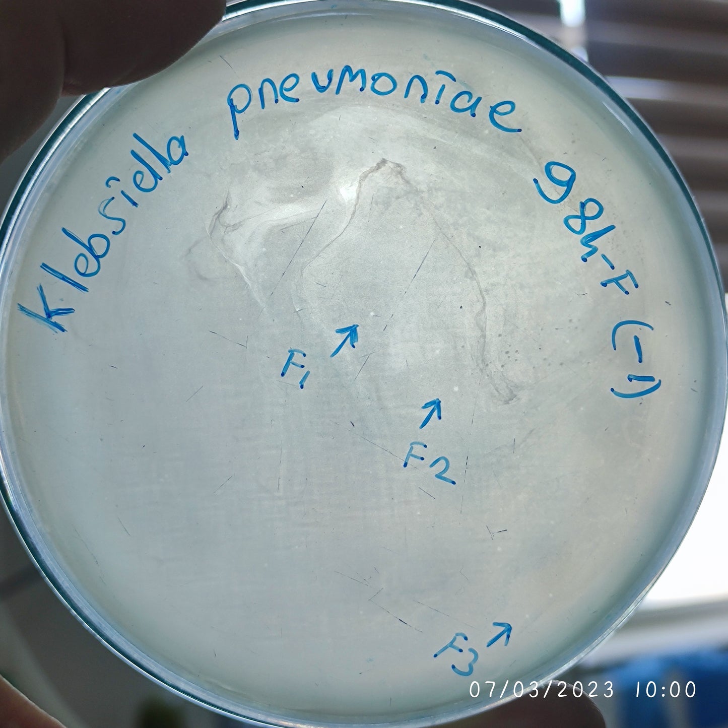 Klebsiella pneumoniae bacteriophage 180984F