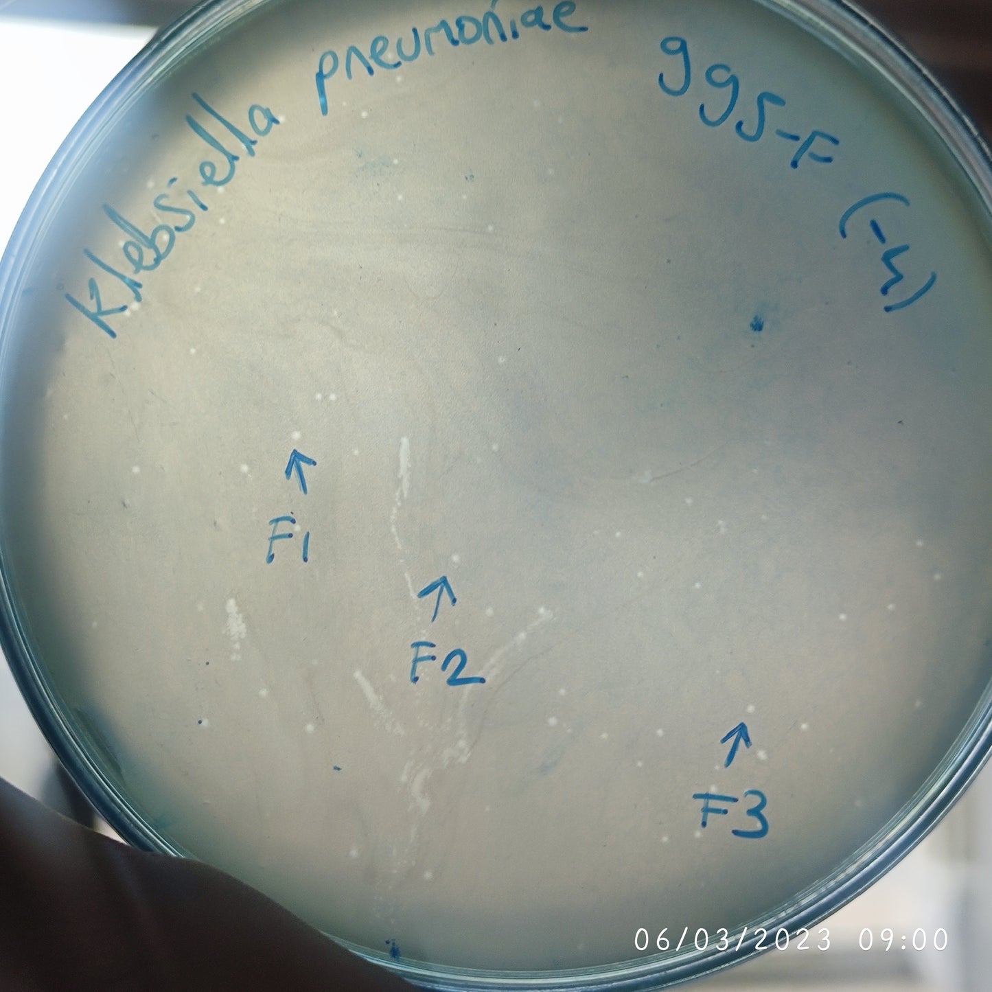 Klebsiella pneumoniae bacteriophage 180995F