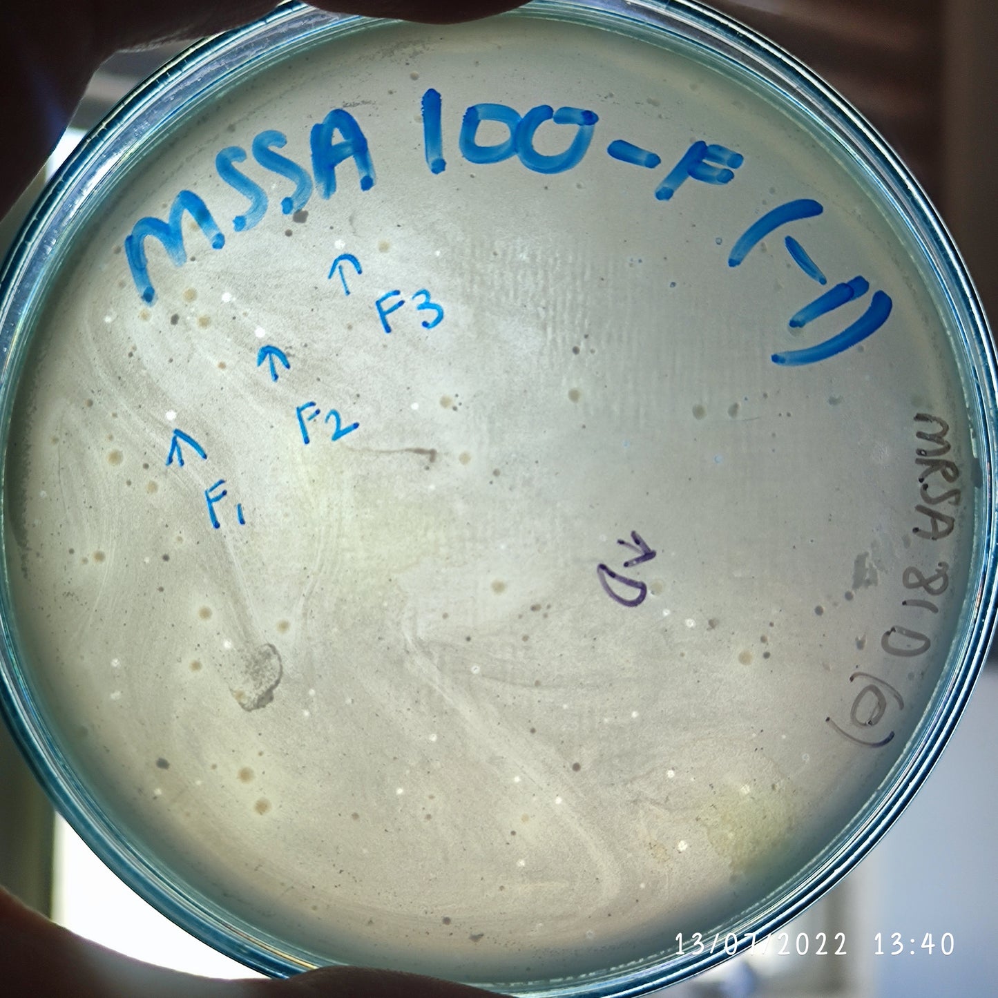 Staphylococcus aureus bacteriophage 152100F
