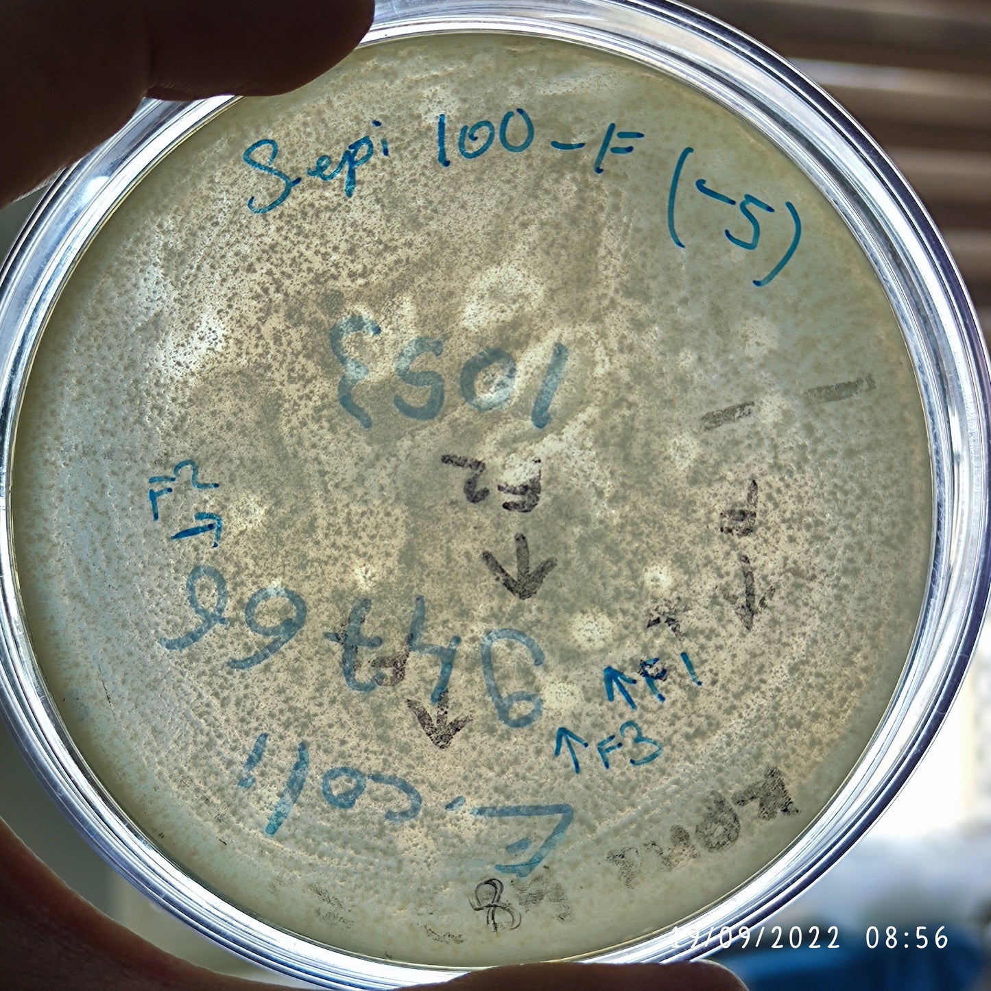 Staphylococcus epidermidis bacteriophage 158100F