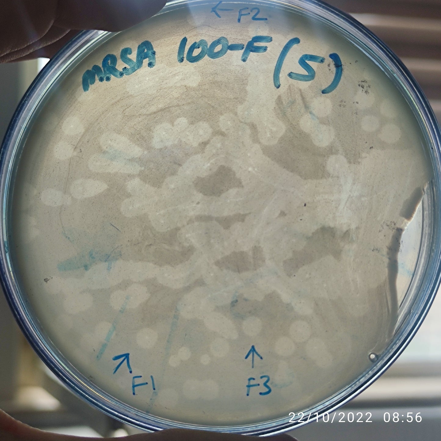Staphylococcus aureus bacteriophage 150100F