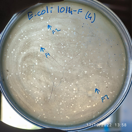 Escherichia coli bacteriophage 101014F