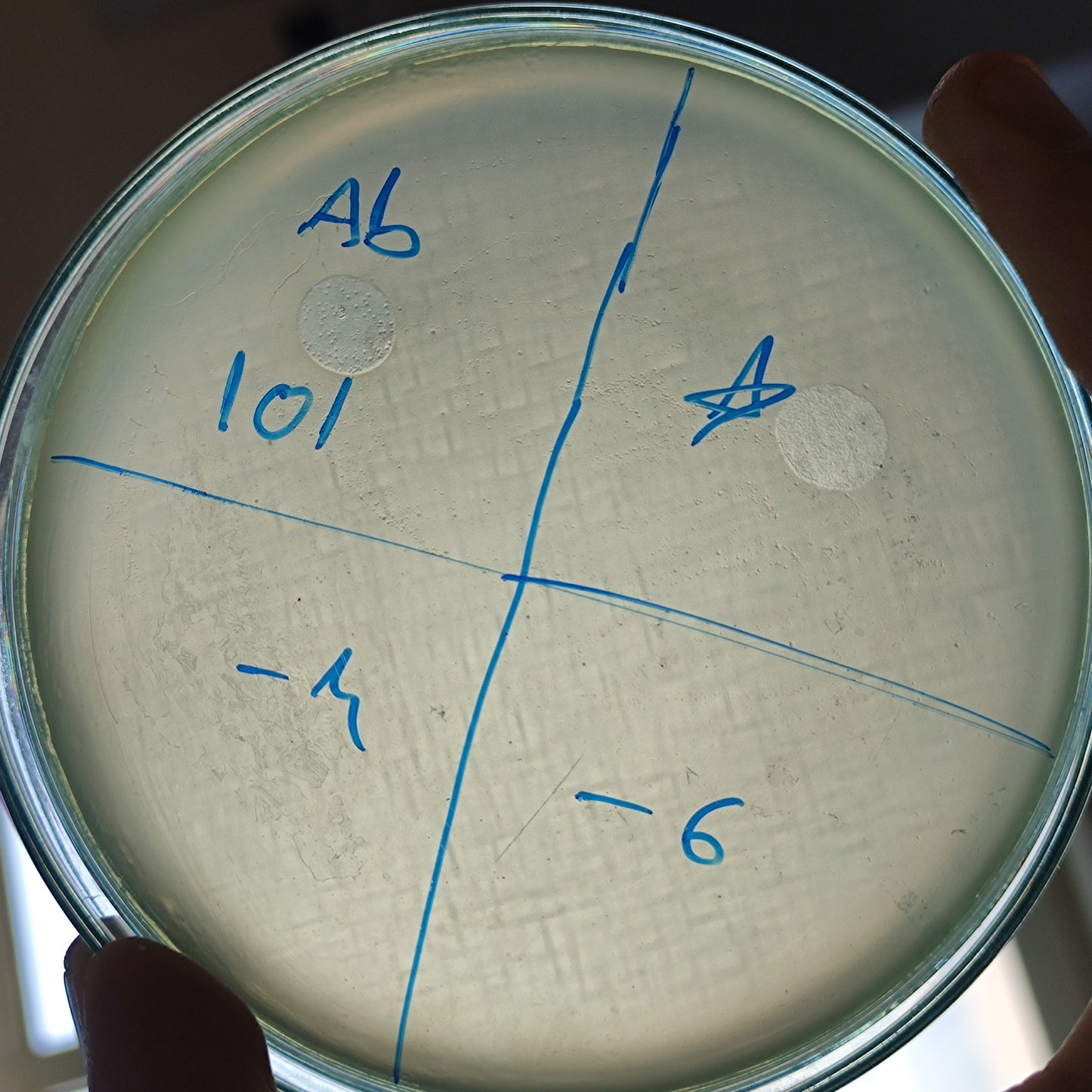 Acinetobacter baumannii bacteriophage 120101A