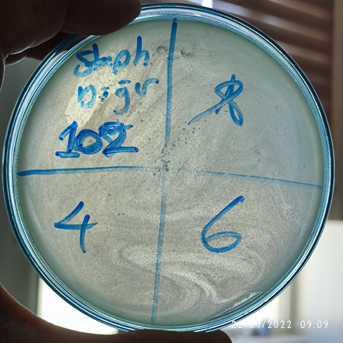 Staphylococcus epidermidis bacteriophage 158102F