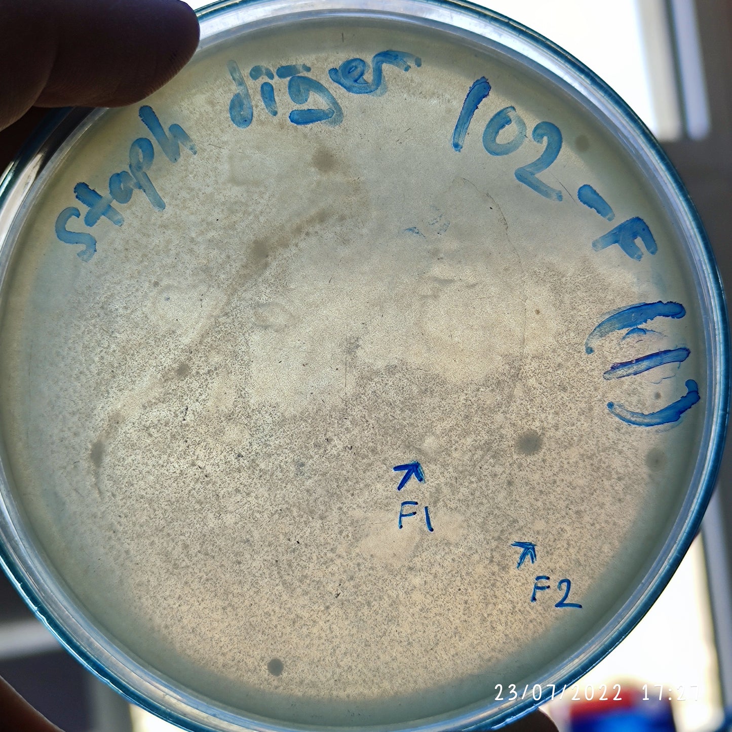 Staphylococcus epidermidis bacteriophage 158102F