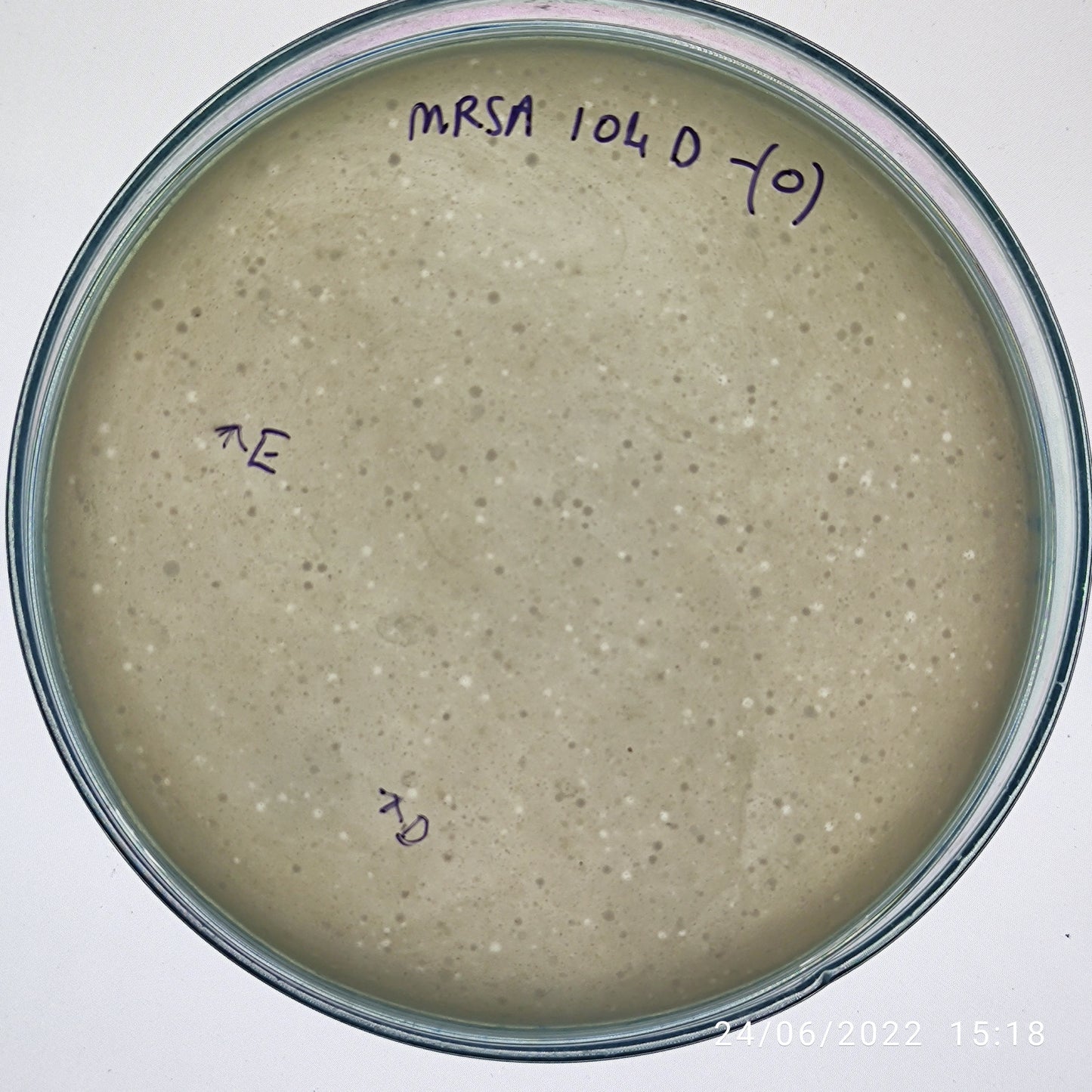 Staphylococcus aureus bacteriophage 150104D
