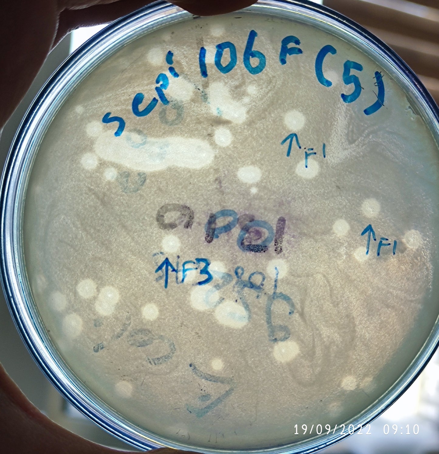 Staphylococcus epidermidis bacteriophage 158106F