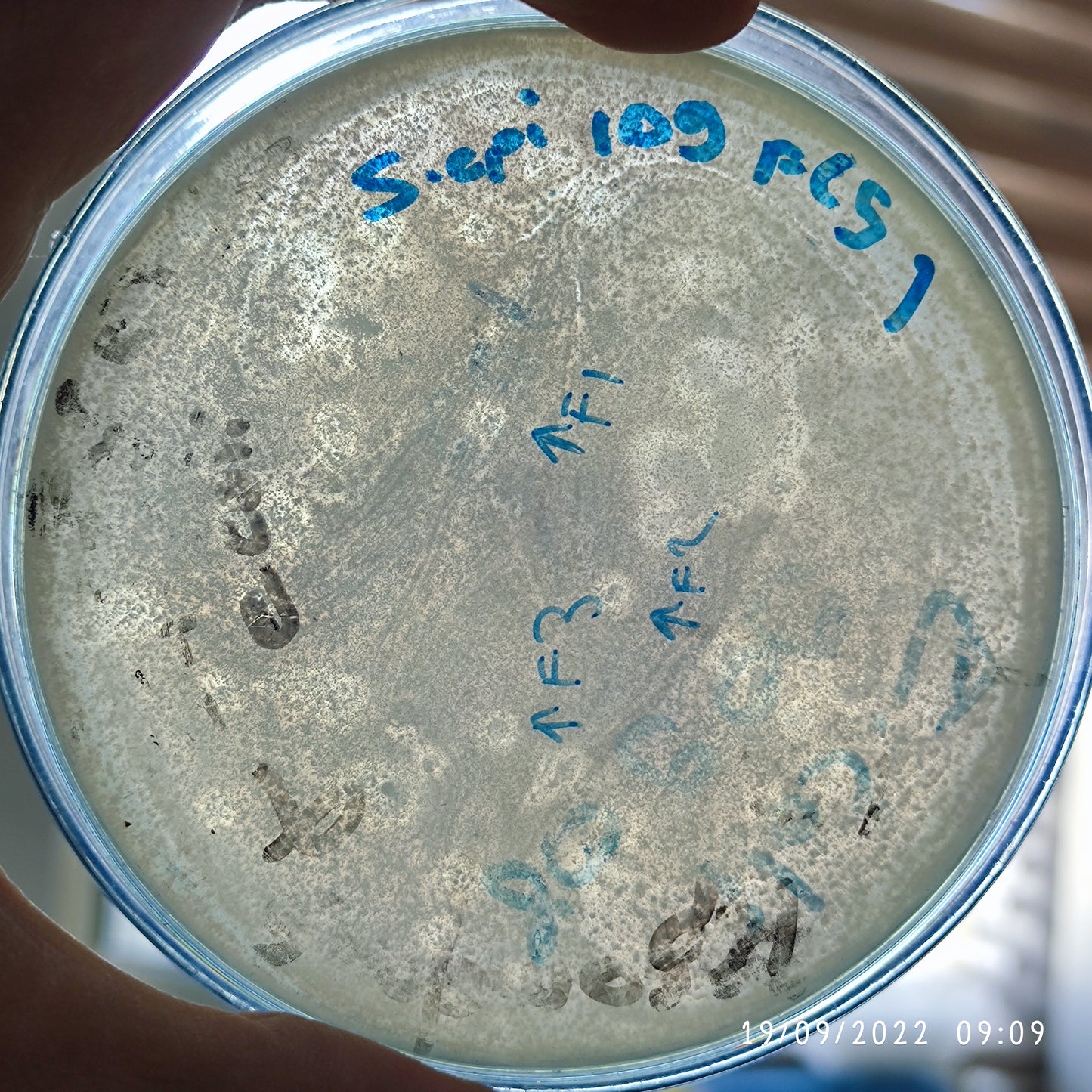 Staphylococcus epidermidis bacteriophage 158109F