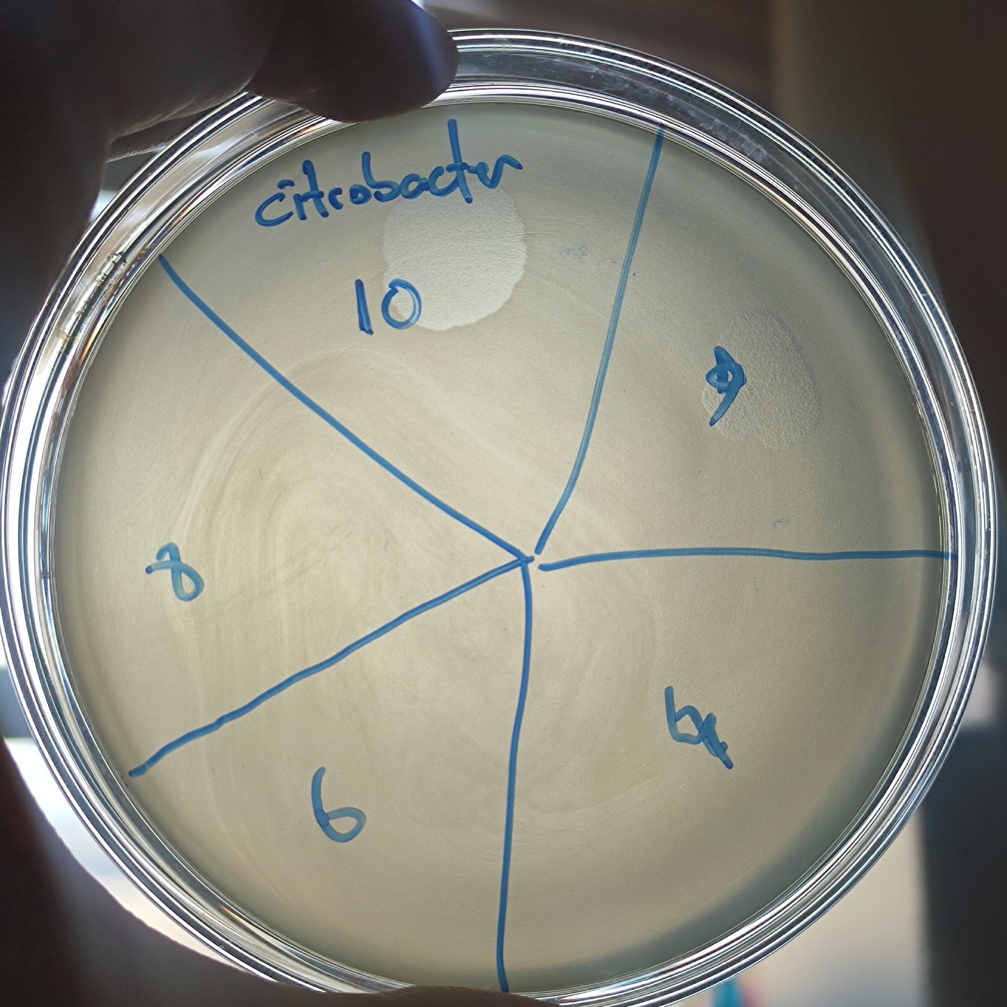 Citrobacter koseri bacteriophage 200010D