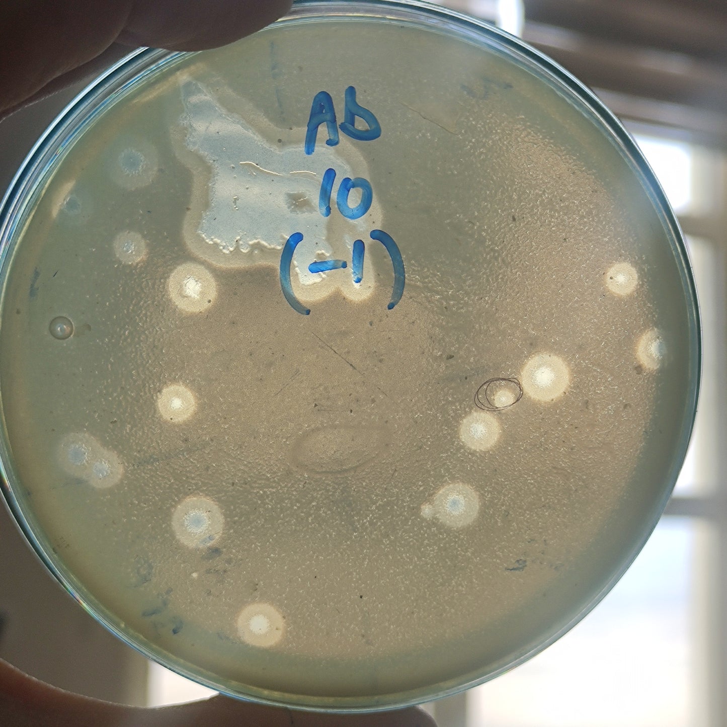 Acinetobacter baumannii bacteriophage 120010D