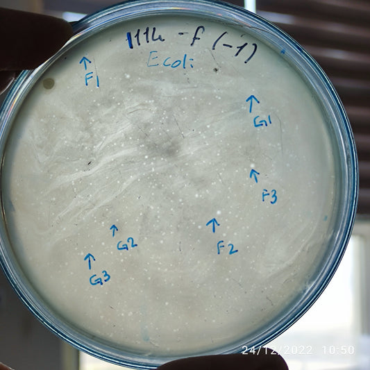 Escherichia coli bacteriophage 101114F