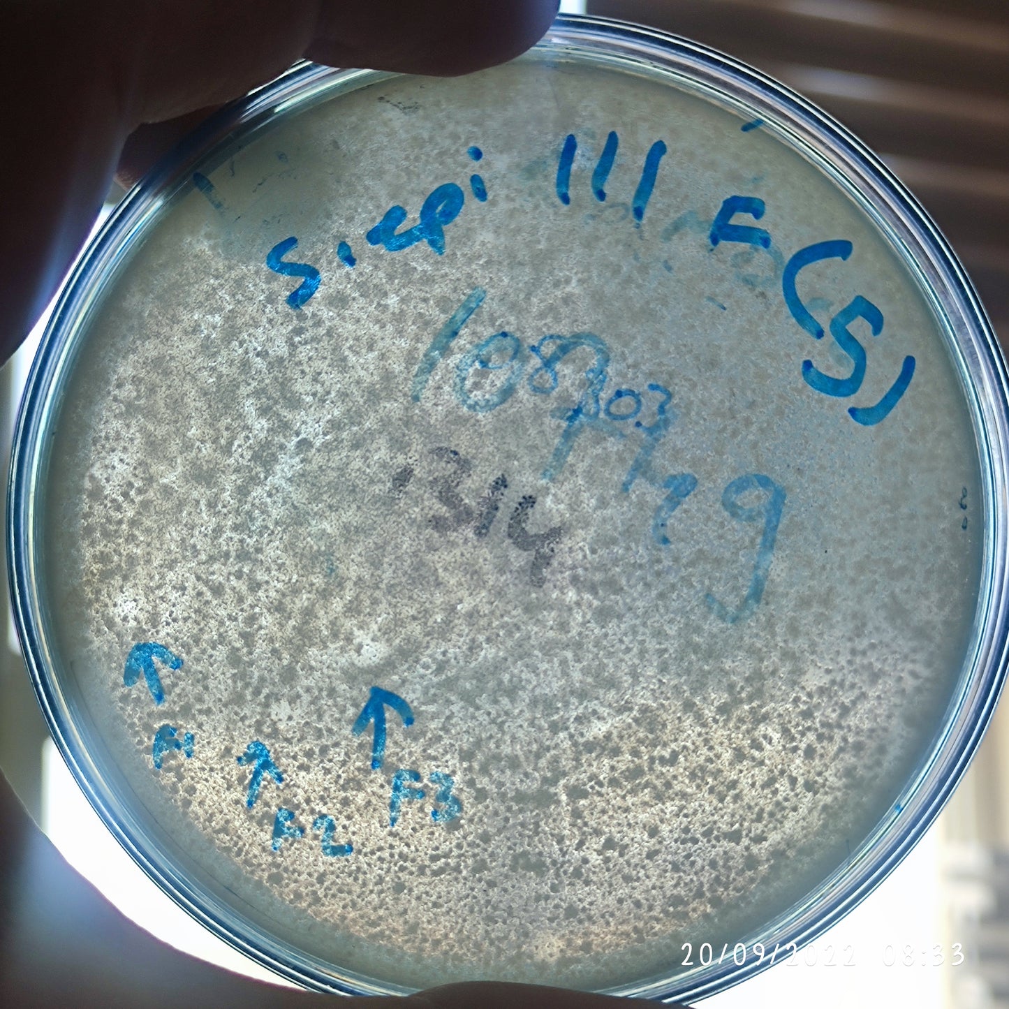 Staphylococcus epidermidis bacteriophage 158111F