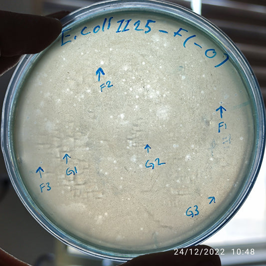 Escherichia coli bacteriophage 101125F