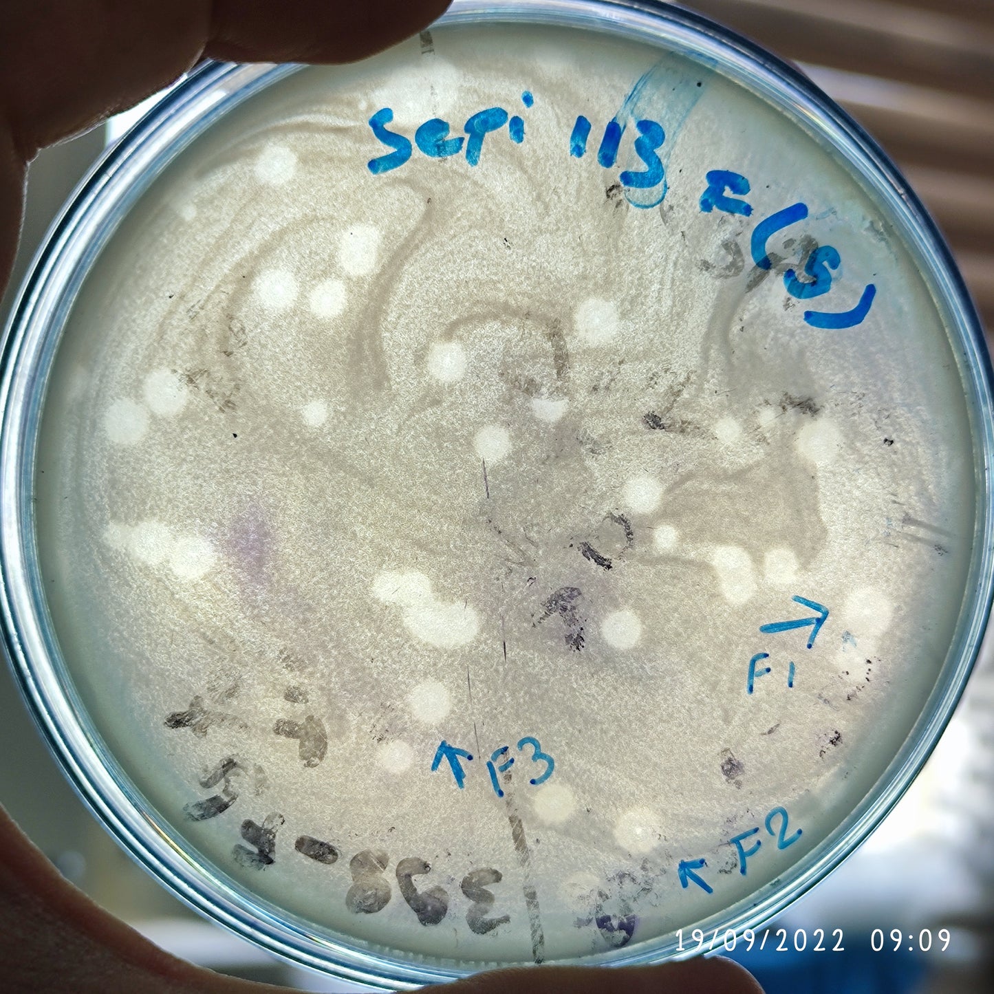 Staphylococcus epidermidis bacteriophage 158113F