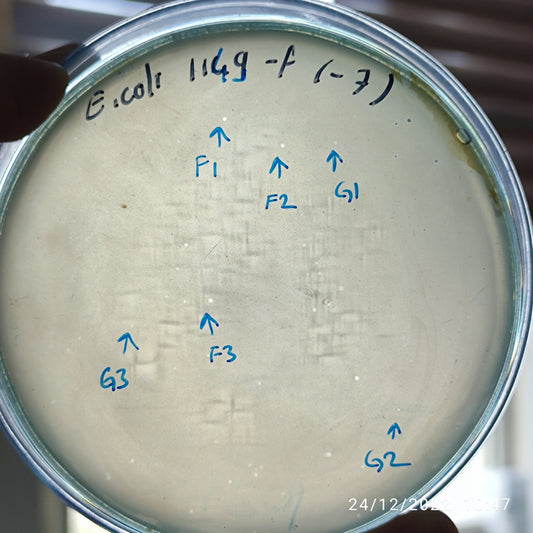 Escherichia coli bacteriophage 101149G
