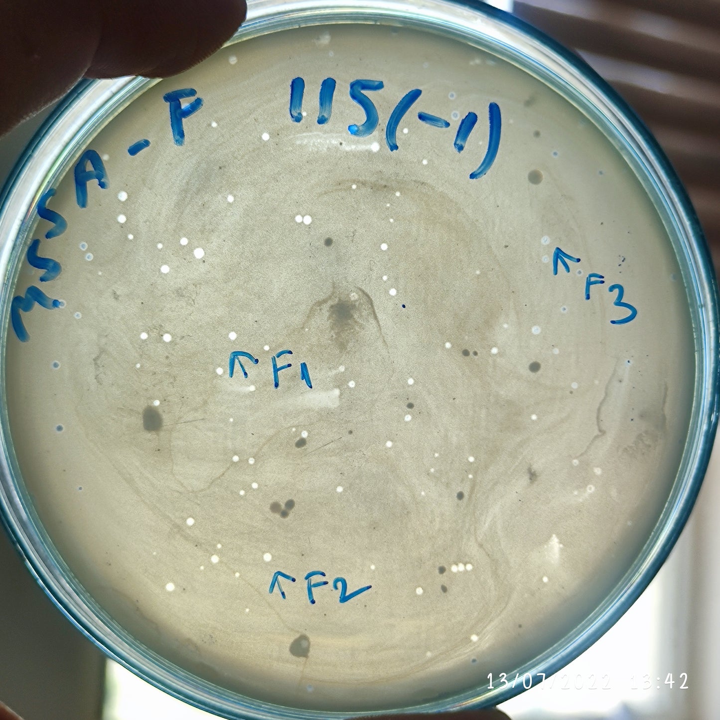 Staphylococcus aureus bacteriophage 150115F