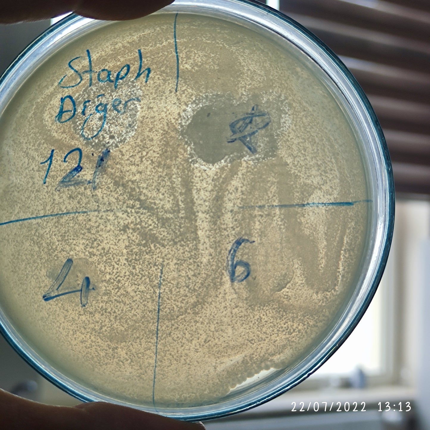 Staphylococcus hominis bacteriophage 158121F