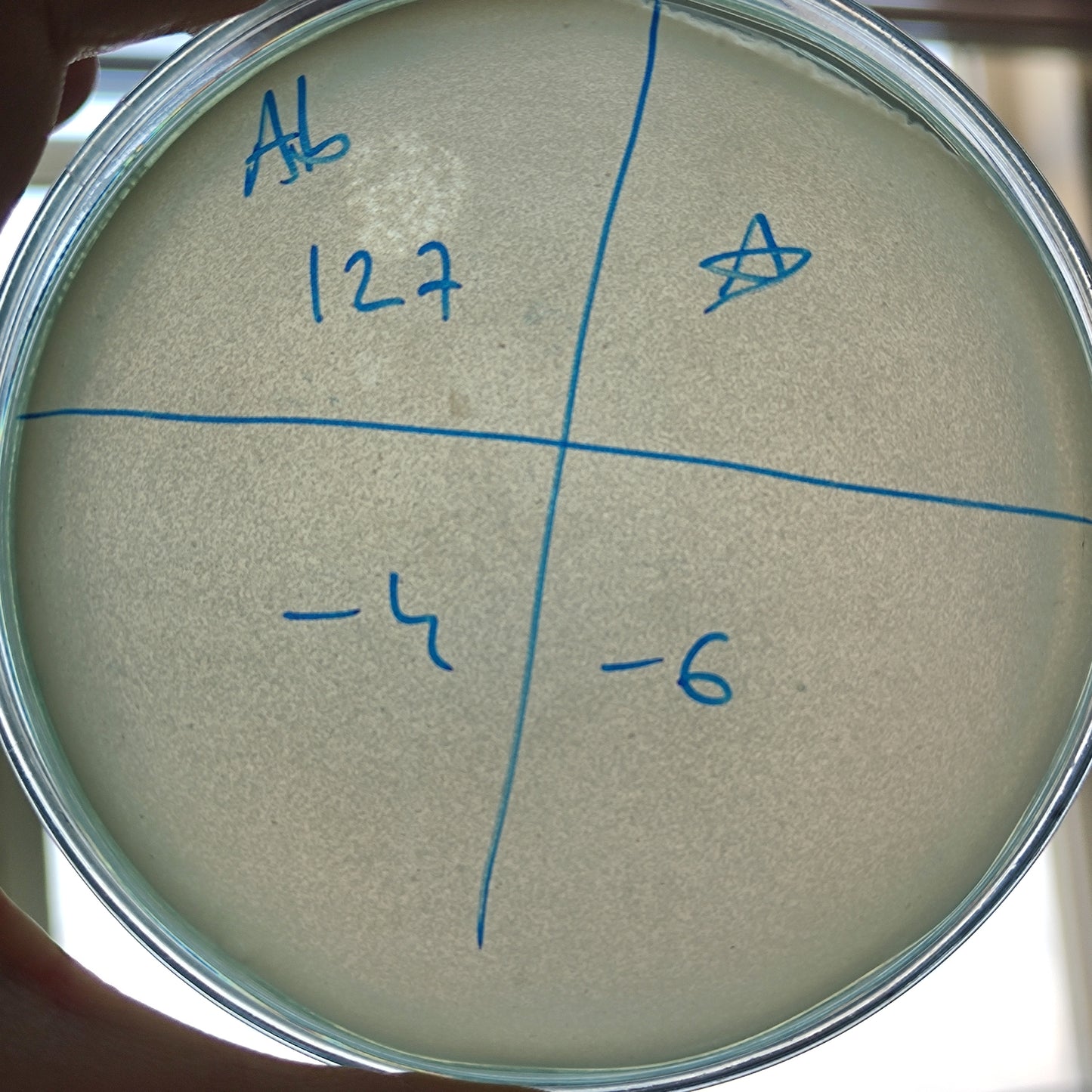 Acinetobacter baumannii bacteriophage 120127A