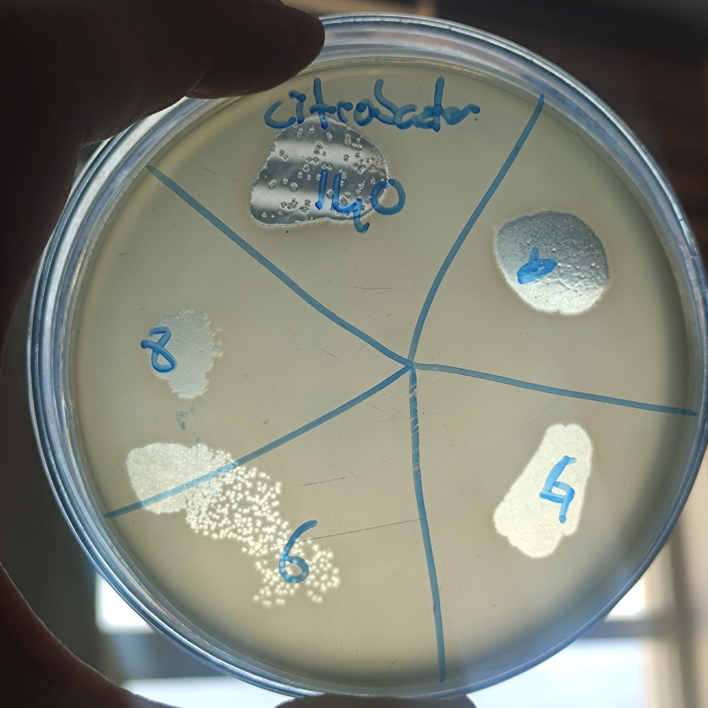 Citrobacter freundii bacteriophage 200140D