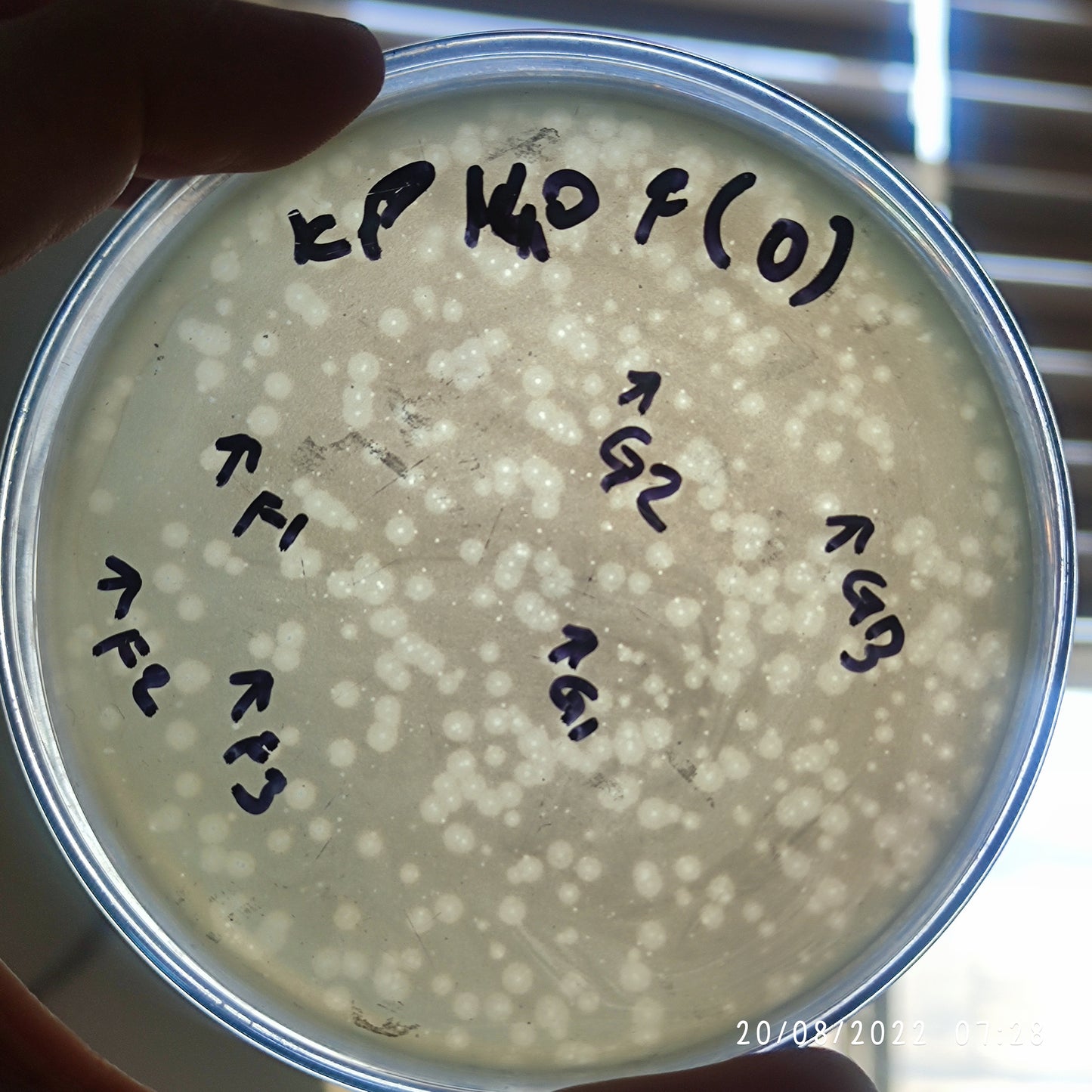 Klebsiella pneumoniae bacteriophage 180140G