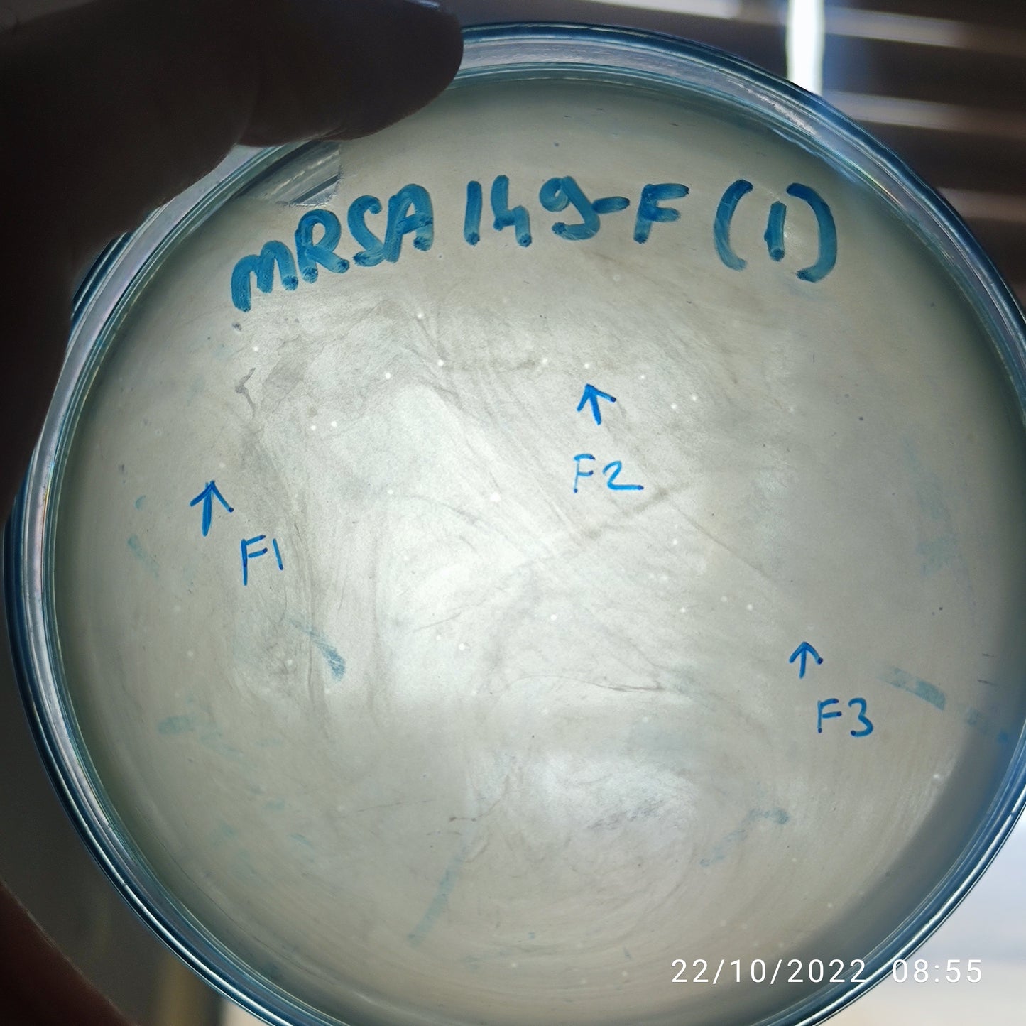 Staphylococcus aureus bacteriophage 150149F