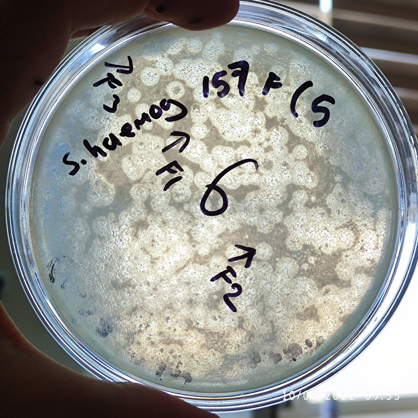 Staphylococcus haemolyticus bacteriophage 158157F
