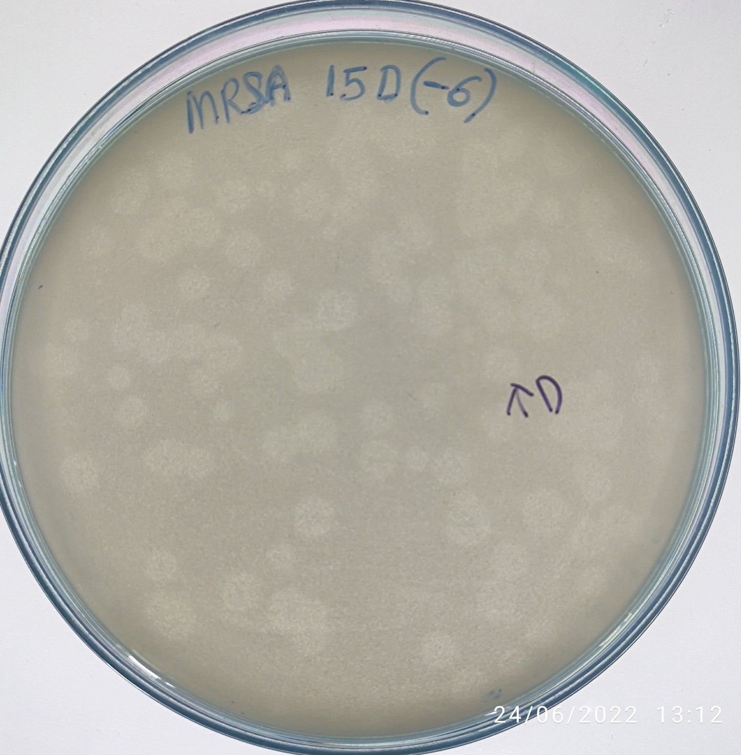 Staphylococcus aureus bacteriophage 150016D