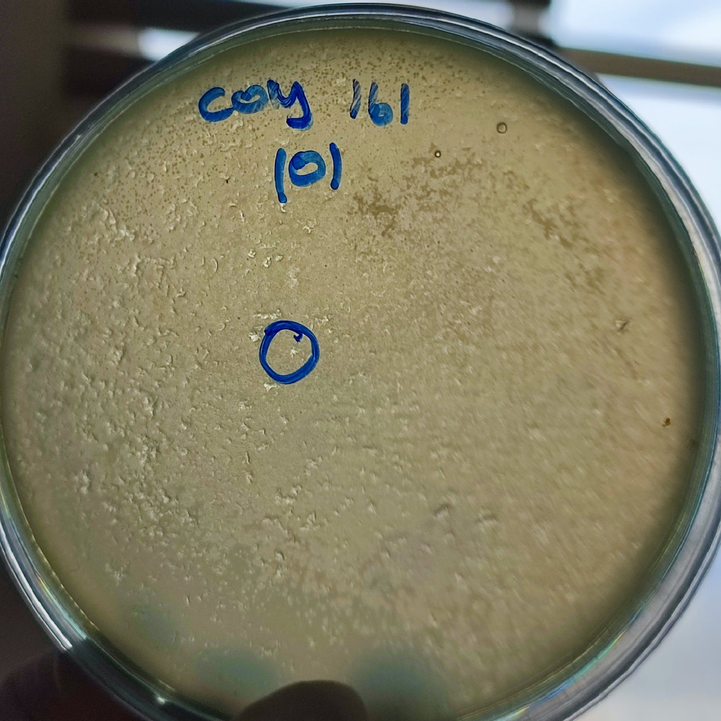 Corynebacterium striatum bacteriophage 200161D