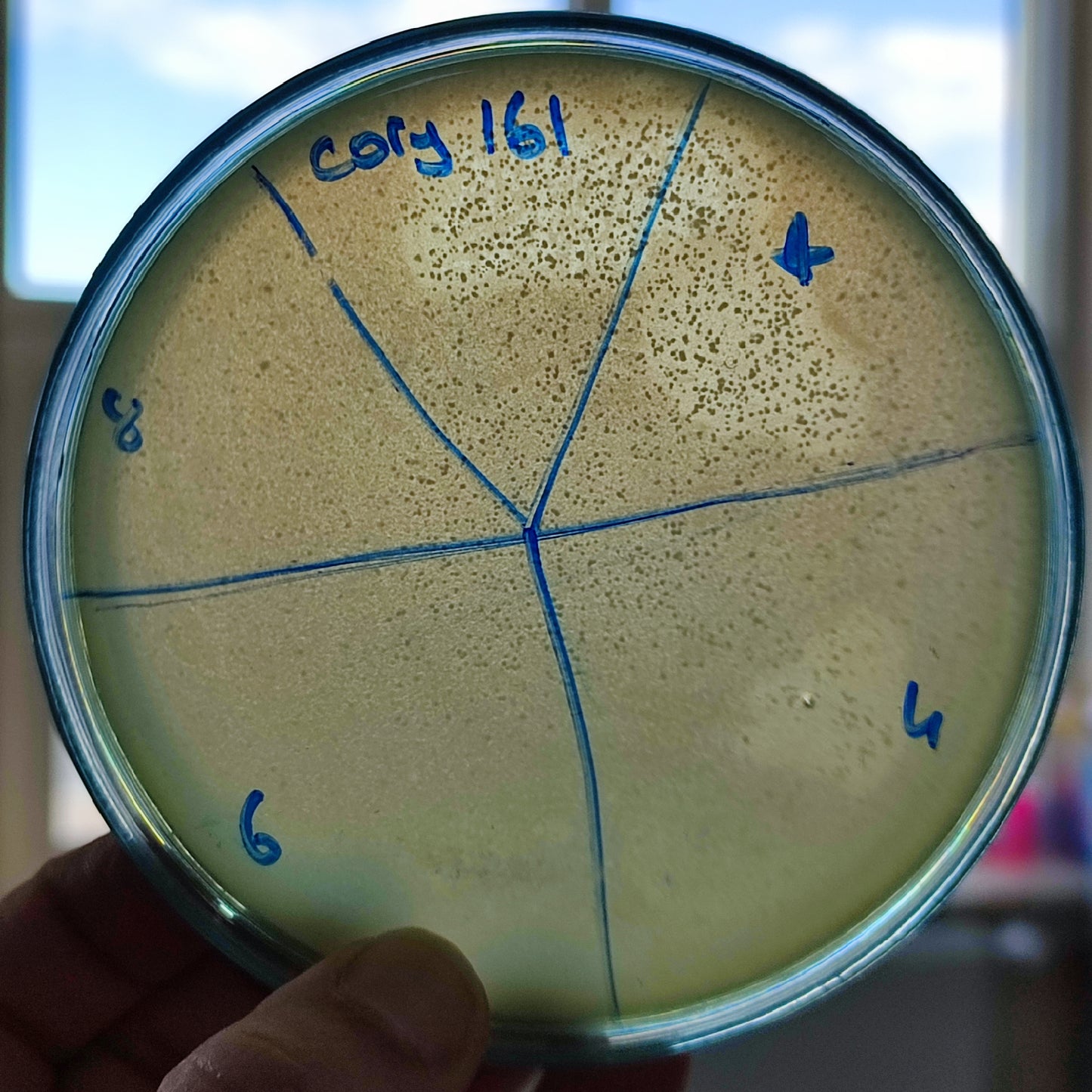 Corynebacterium striatum bacteriophage 200161D