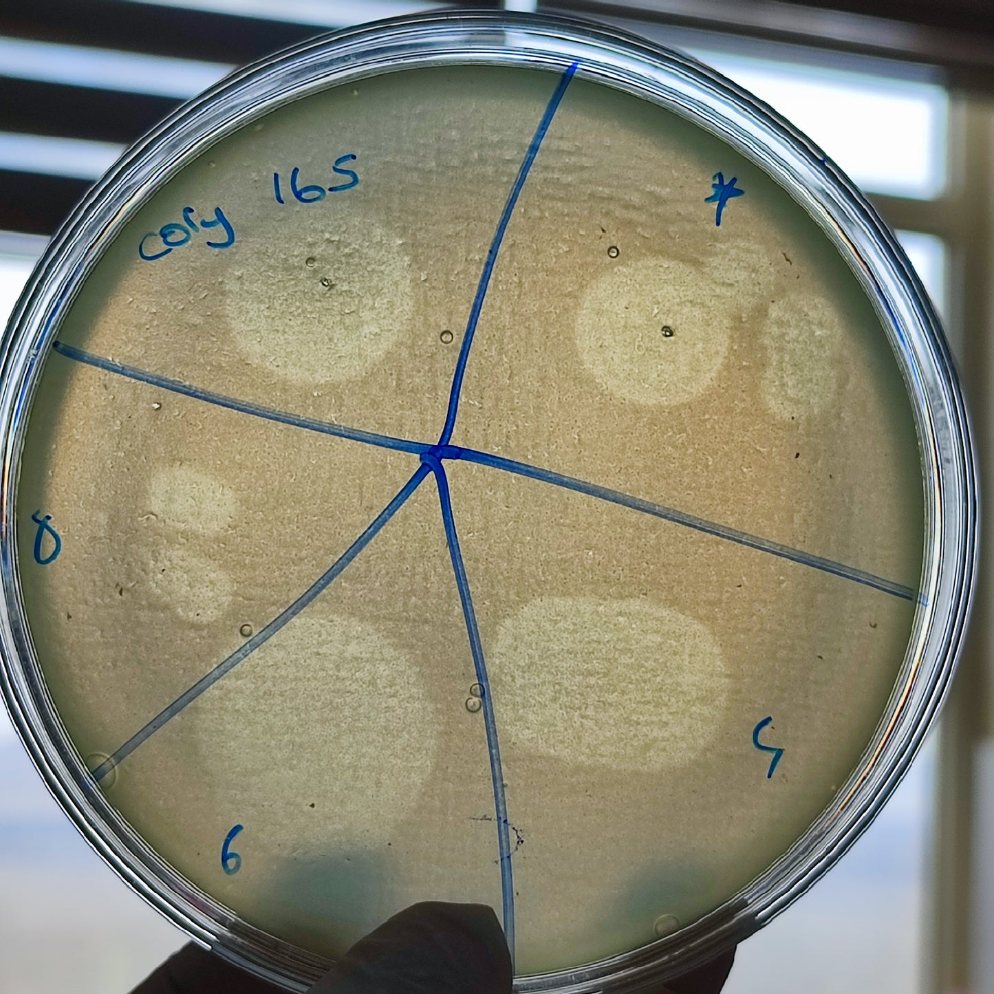 Corynebacterium striatum bacteriophage 200165D