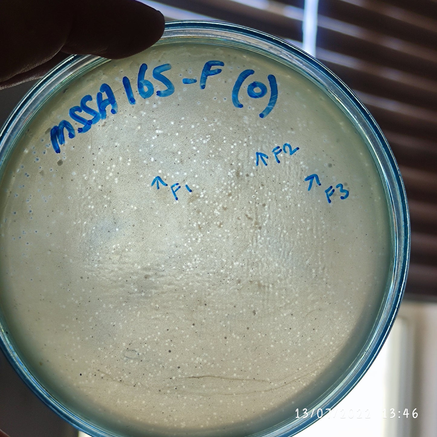 Staphylococcus aureus bacteriophage 152165F